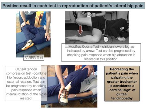 leap test for gluteal tendonitis